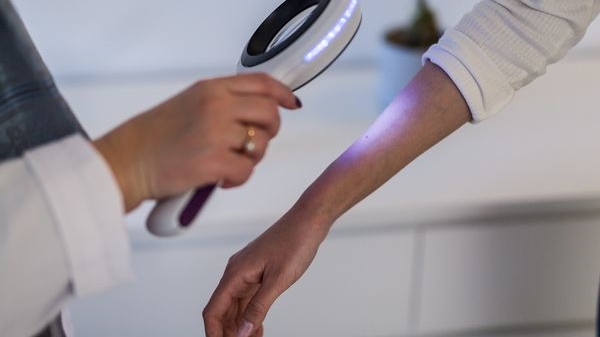 Preventivni pregledi ranog otkrivanja zloćudnih tumora kože