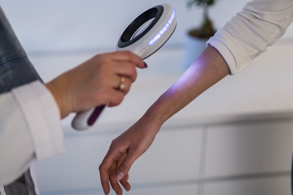 Preventivni pregledi ranog otkrivanja zloćudnih tumora kože